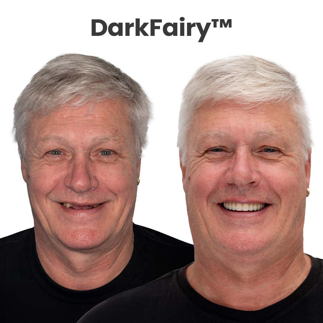 ๐ฆทDarkFairyโข Custom-Fit Dentures โฐ ENDS TODAY 70% OFF | Smile with Confidence